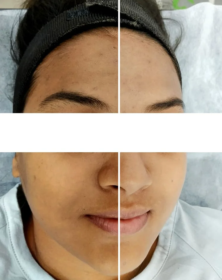 Sirpi-Service-Img-4